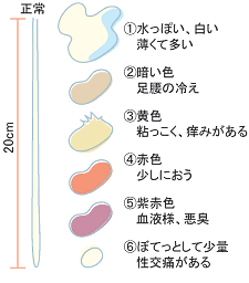 妊娠 白いおりもの